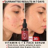 ANTI ACNE & GLOWING SERUM VITAMIN C + E