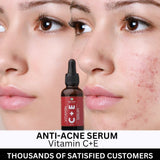 ANTI ACNE & GLOWING SERUM VITAMIN C + E