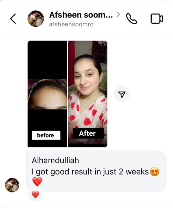 ANTI ACNE  SERUM REMOVE ACNE IN 3 DAYS !