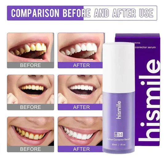 HiSmile V34™ – No More Yellow Stains, Just Bright Smiles