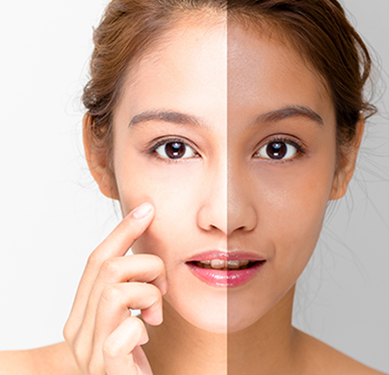 VITAMIN C SKIN POLISH (INSTANT BRIGHTENING RESUULTS )
