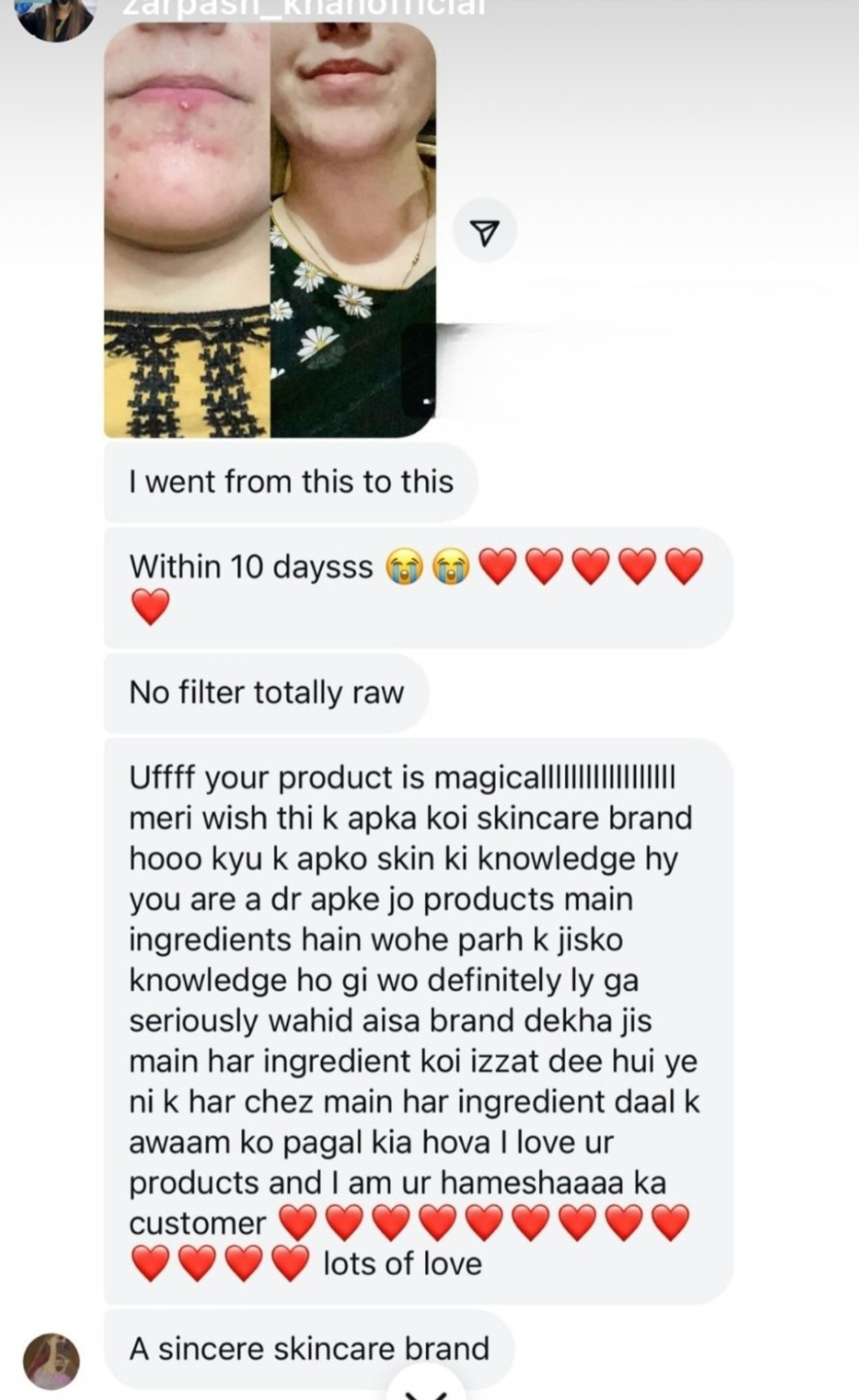 ANTI ACNE  SERUM REMOVE ACNE IN 3 DAYS !