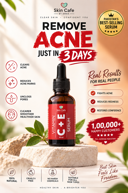 ANTI ACNE  SERUM REMOVE ACNE IN 3 DAYS !