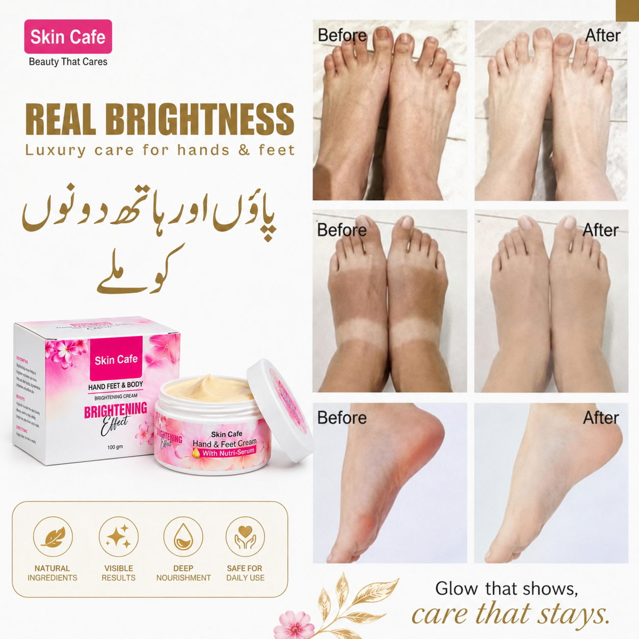 HAND FEET WHITENING CREAM (7 DAYS GURRANTTEE RESULTS )